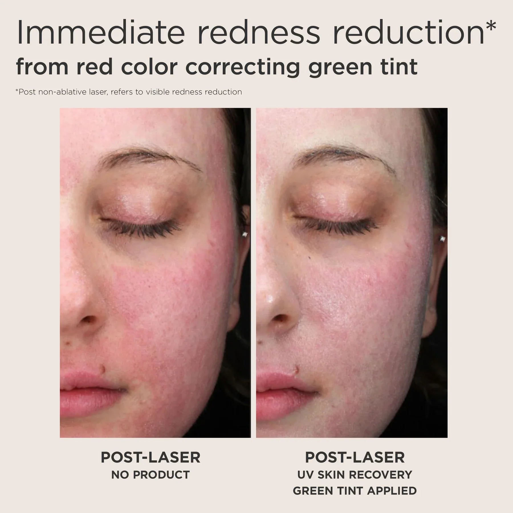 UV Skin Recovery Red Color Correcting SPF50 GREEN TINT