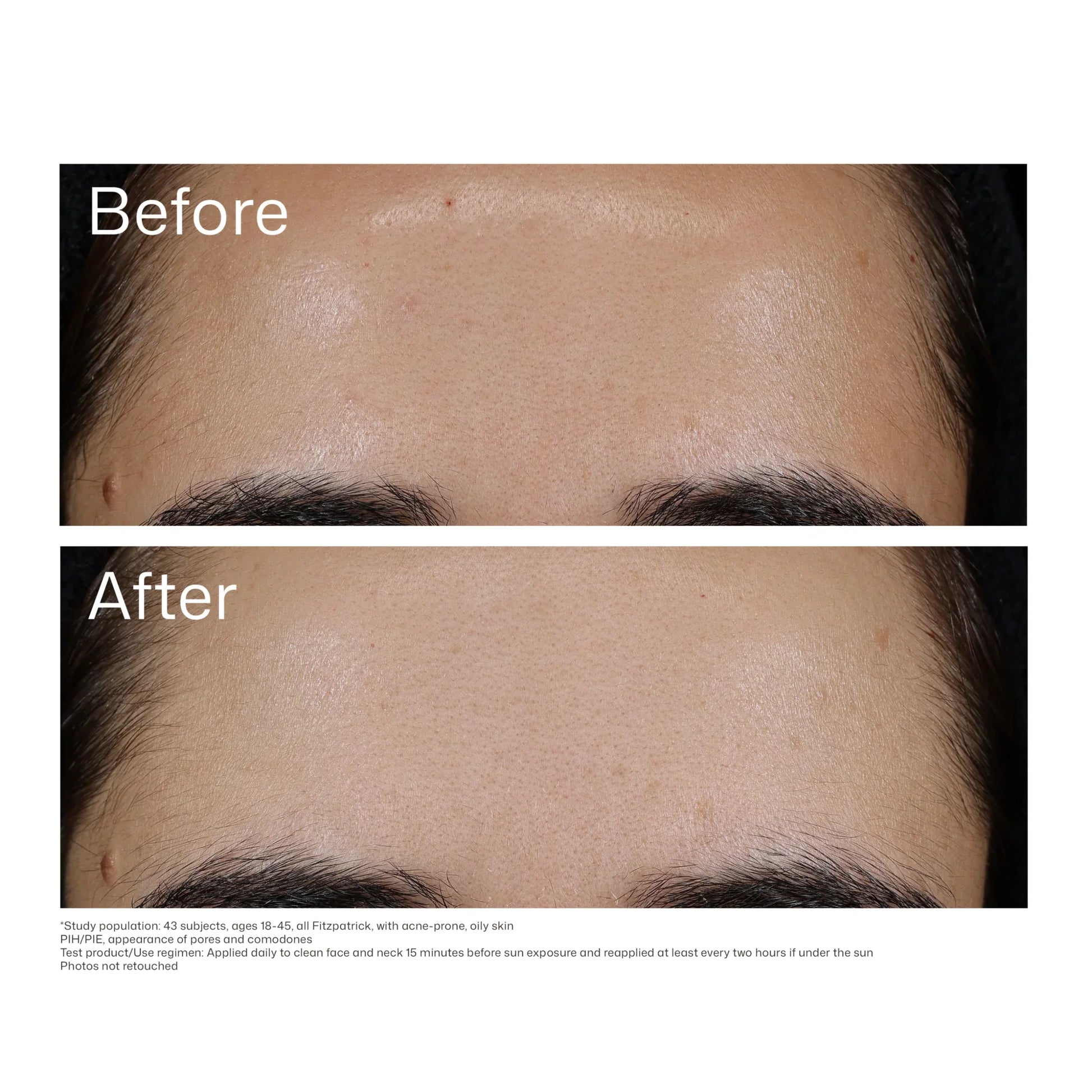 UV Clear Blemish-Prone & Oil Balancing SPF50