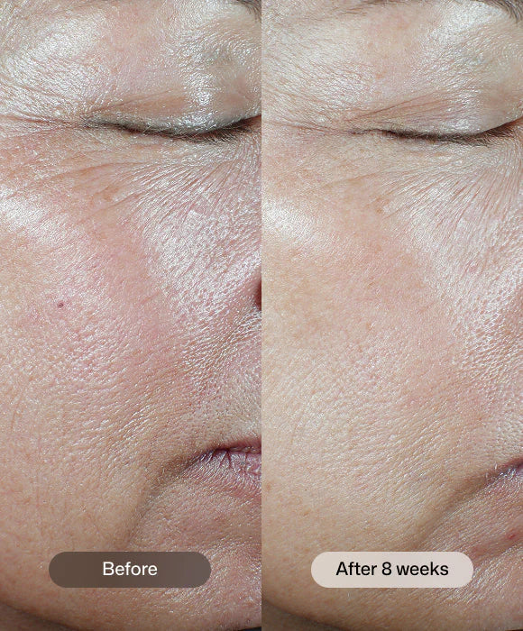 C+ Correcting Complex 30%