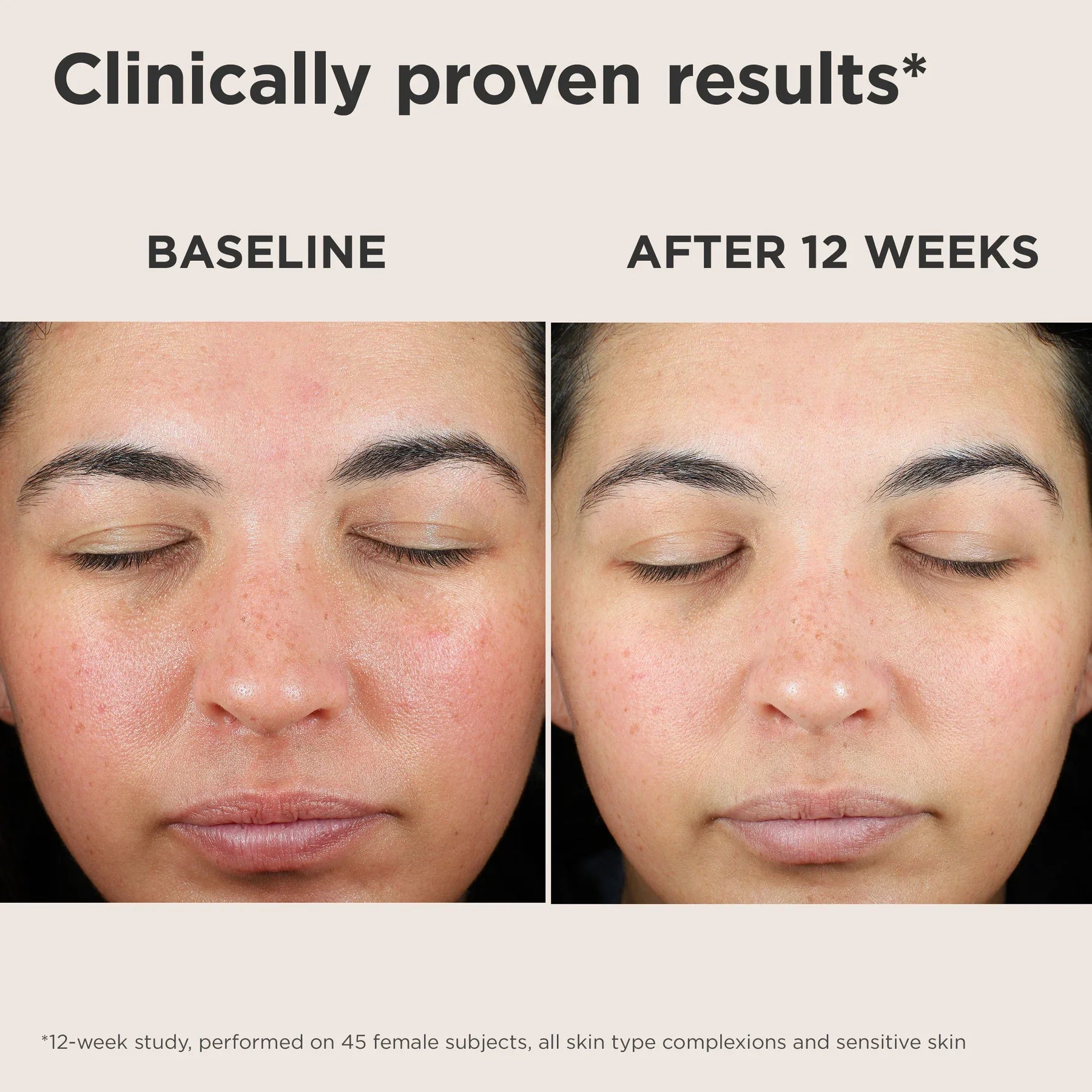 UV Skin Recovery Broad Spectrum SPF50 Face Sunscreen