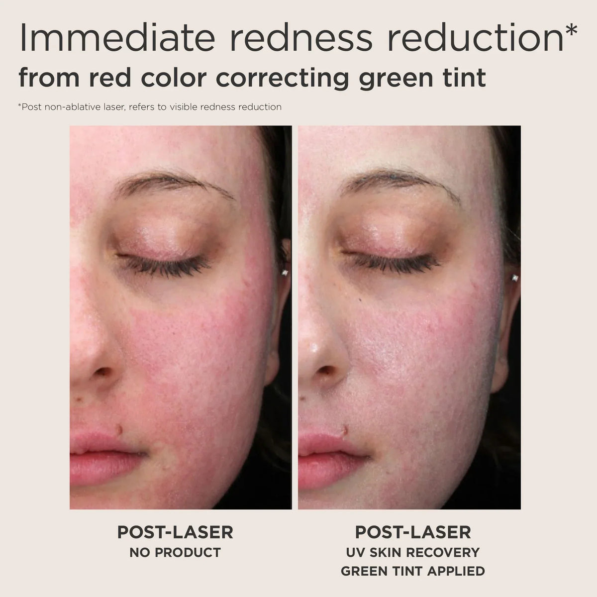UV Skin Recovery Red Color Correcting SPF50 GREEN TINT